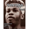 Trauma
